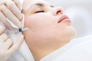 Mesotherapie voor de huid